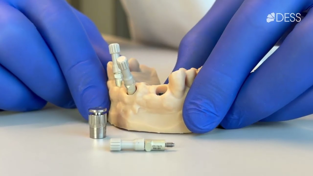 How to place a scanbody