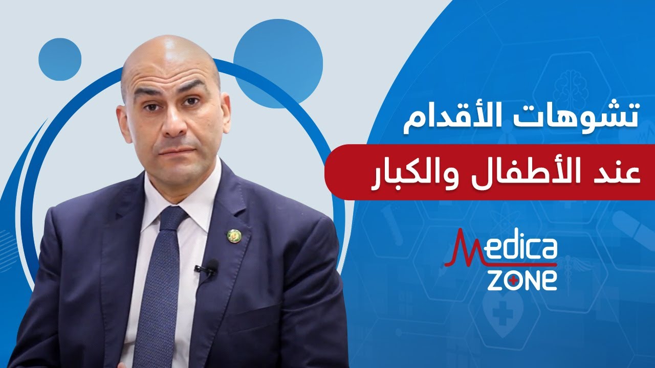 تشوهات الأقدام عند الأطفال و الكبار مع الدكتور خالد عمارة | Medicazone