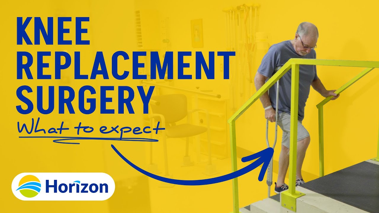 Knee Replacement Surgery - What you need to know before, during and after