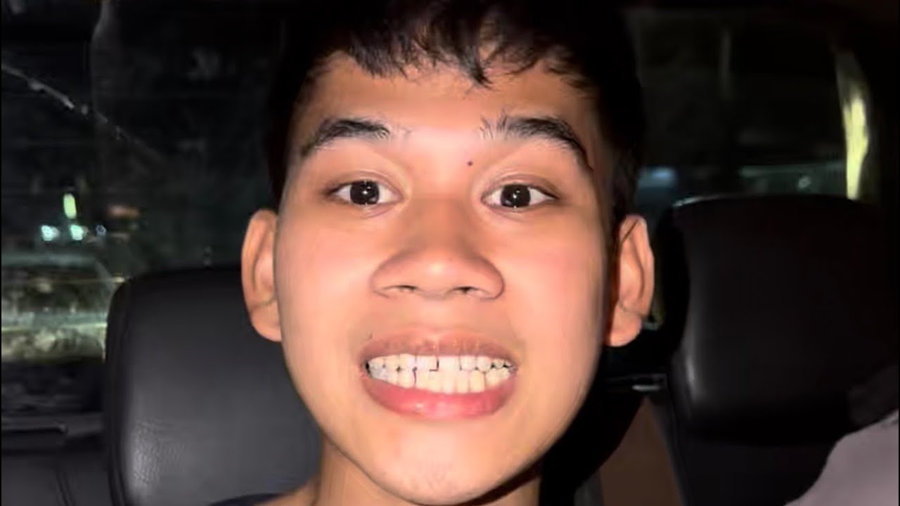 Dinala na namin si John Ashley sa Psychiatrist! Gagalong na kaya sya ng tuluyan? 