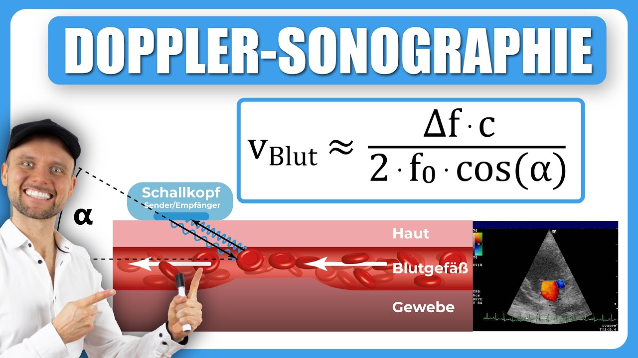 Doppler-Sonographie (Blutfließgeschwindigkeit)