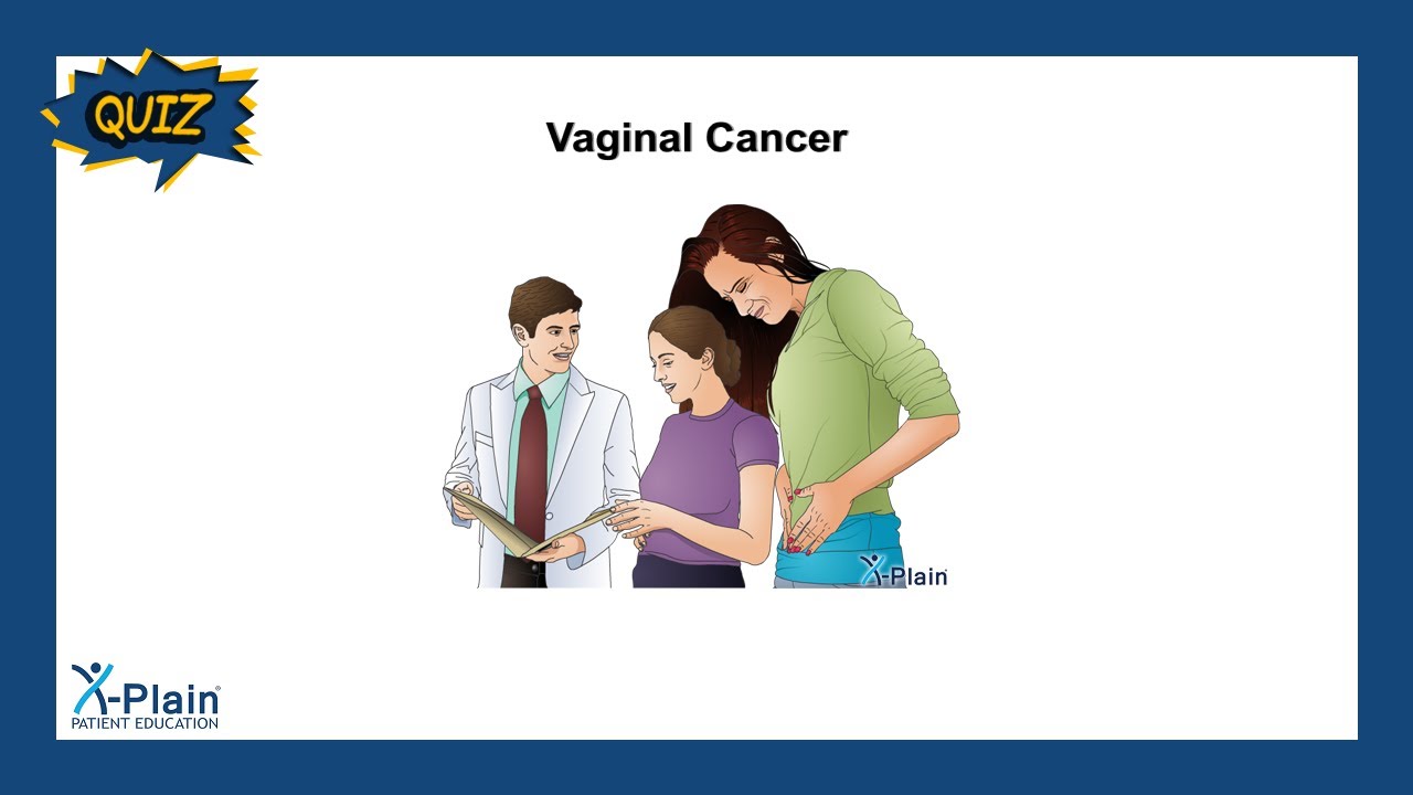 Vaginal Cancer - Quiz