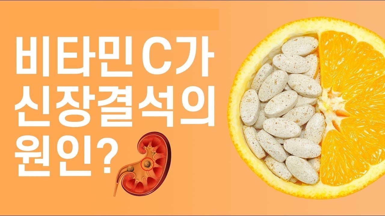 비타민C와 옥살산의 누명 [신장결석2탄]