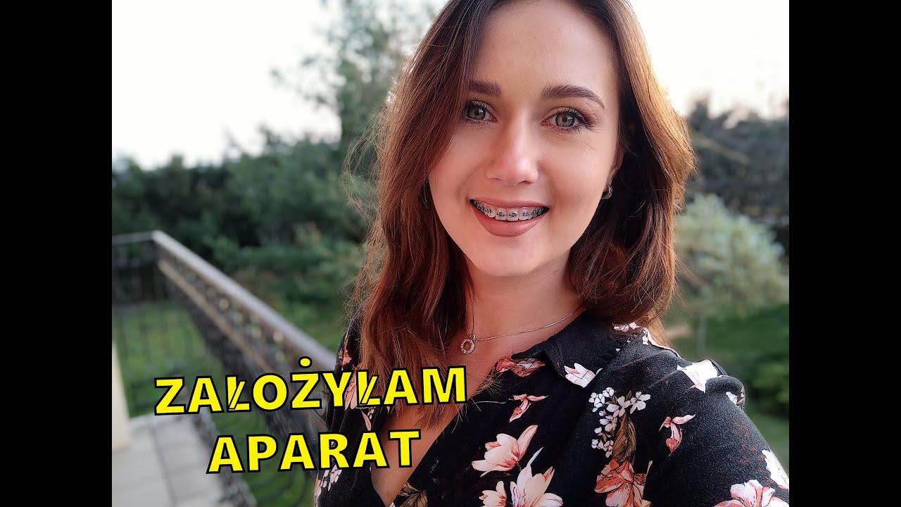 M&Oacute;J UŚMIECH NIE BĘDZIE JUŻ TAKI SAM - ZAŁOŻYŁAM APARAT - POGADAJMY |AgroLovers