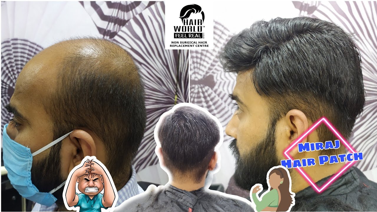 MIRAJ HAIR PATCH | HAIR WIG | HAIR FIXING FOR MEN | BEFORE & AFTER MIRAJ  | BY HAIR WORLD ™