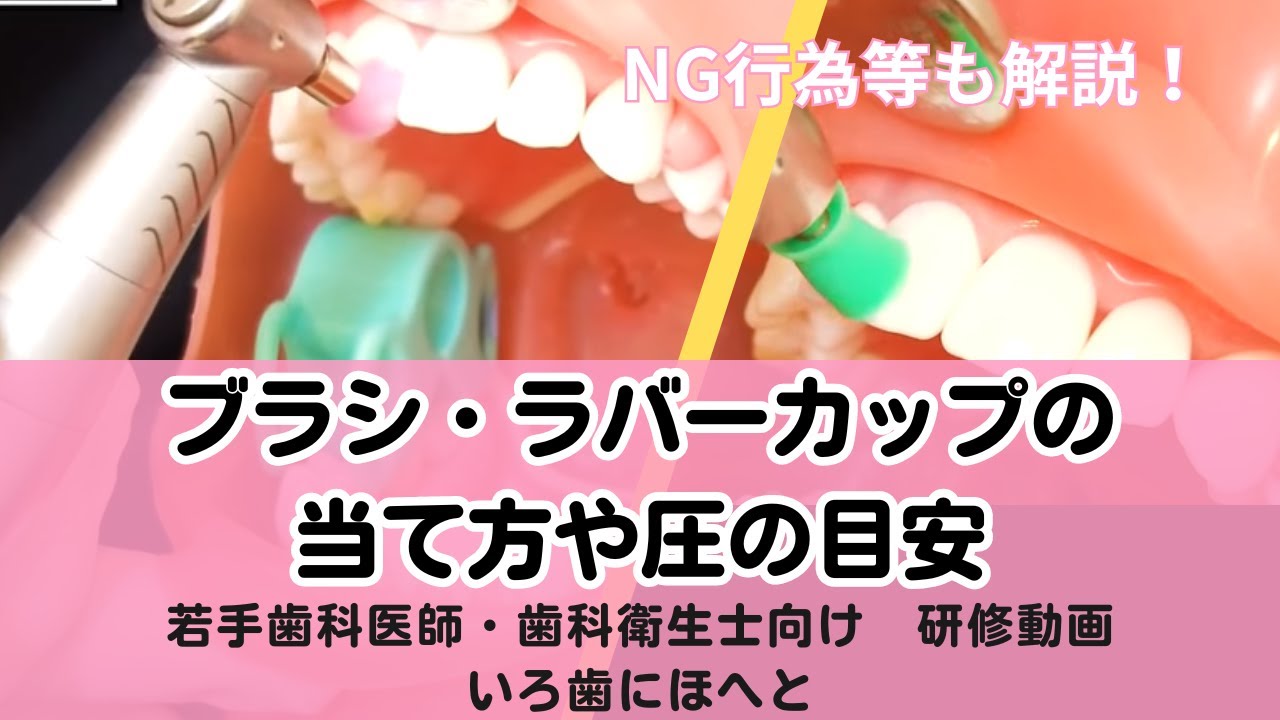 ブラシ・ラバーカップの当て方や圧の目安、NG行為等解説