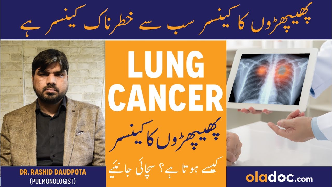 Lung Cancer Symptoms Treatment In Urdu - Phephron Ka Cancer Kaise Hota Hai - Lung Cancer Ka Ilaj