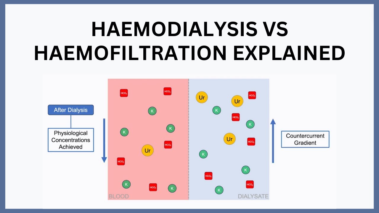 Haemodialysis vs Haemofiltration Explained