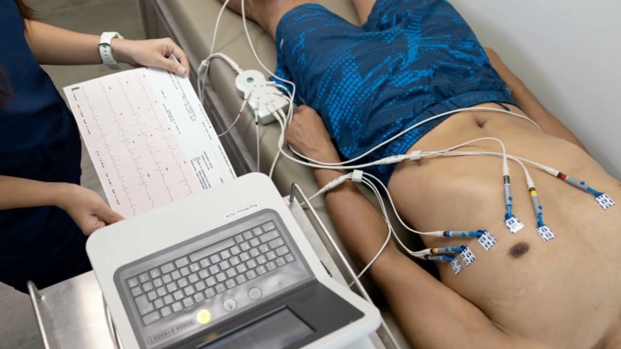 ECG – Elettrocardiogramma: cosa rivela davvero sul cuore.