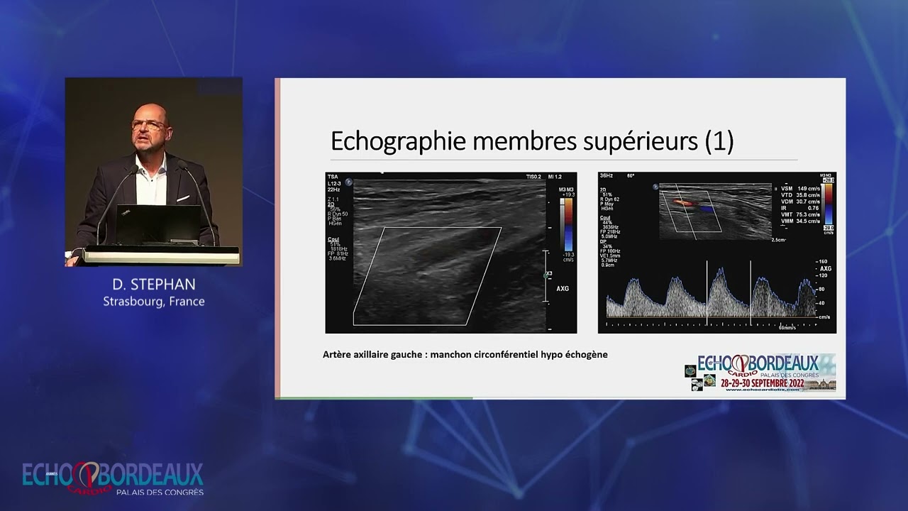 Lésions des troncs supra-aortiques d’origine non athéromateuse