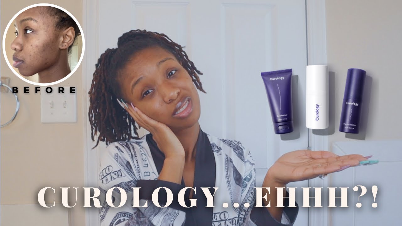 I Tried Curology For 30 Days & This Happened (Honest Review!) Hormonal Acne + Blemishes