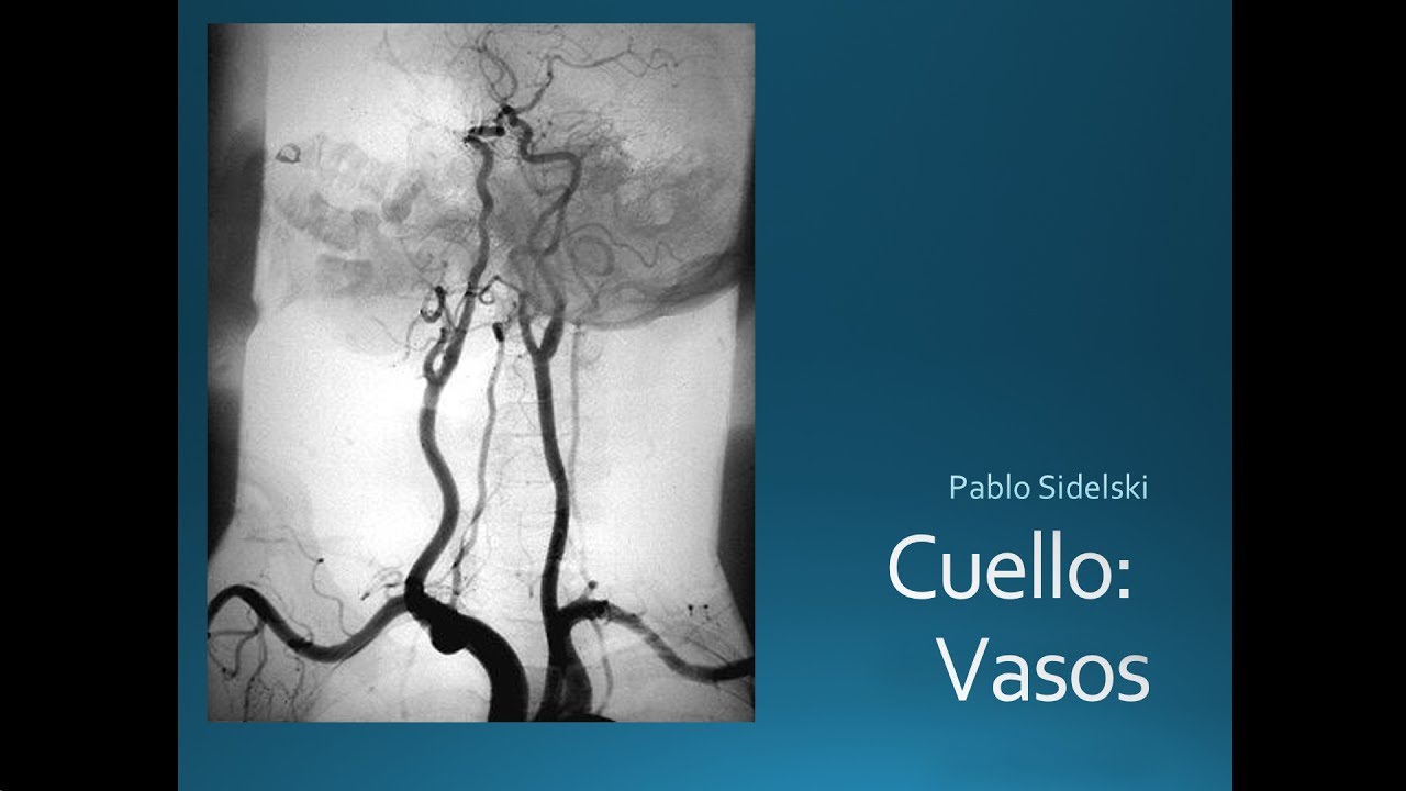 Cuello: Vasos