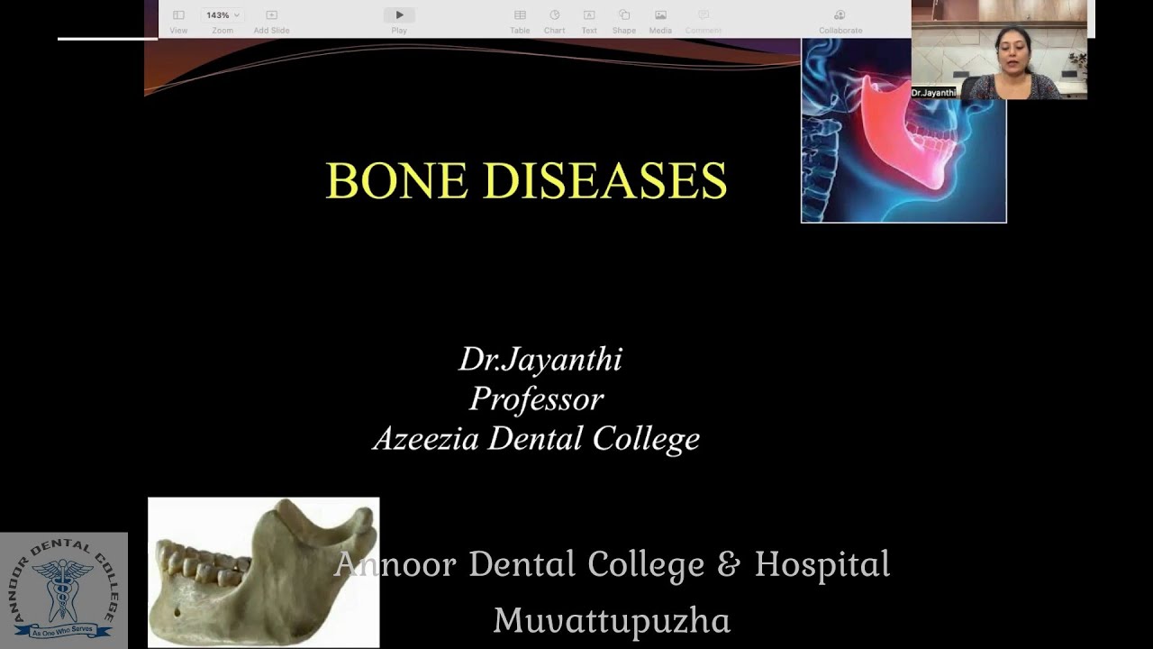 Exam tips 2022: Diseases of Bone _ Dr Jayanthi P