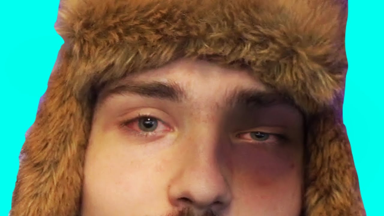 PUNCHED IN THE FACE