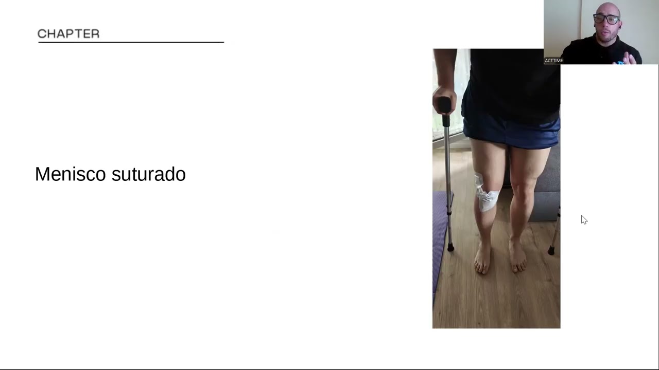 Ligamento Cruzado Anterior: Ejercicios y rehabilitacion Fase 1