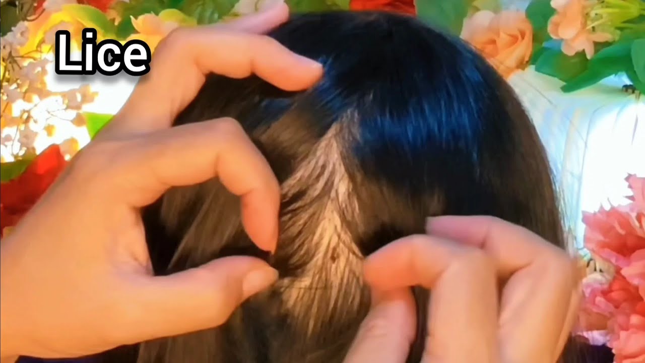 ASMR Satisfying I will help remove your fleas | No Talking 😴💤🥱