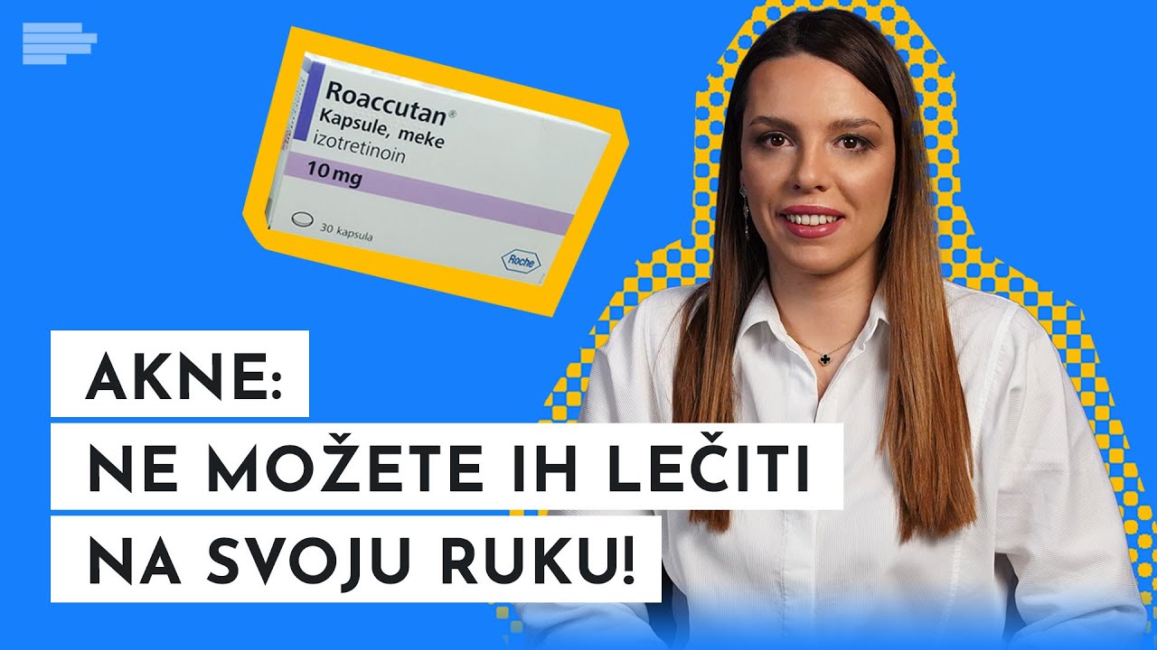 Akne: Ne možete ih dobiti od šećera i mleka, a OVAKO možete da ih pobedite!