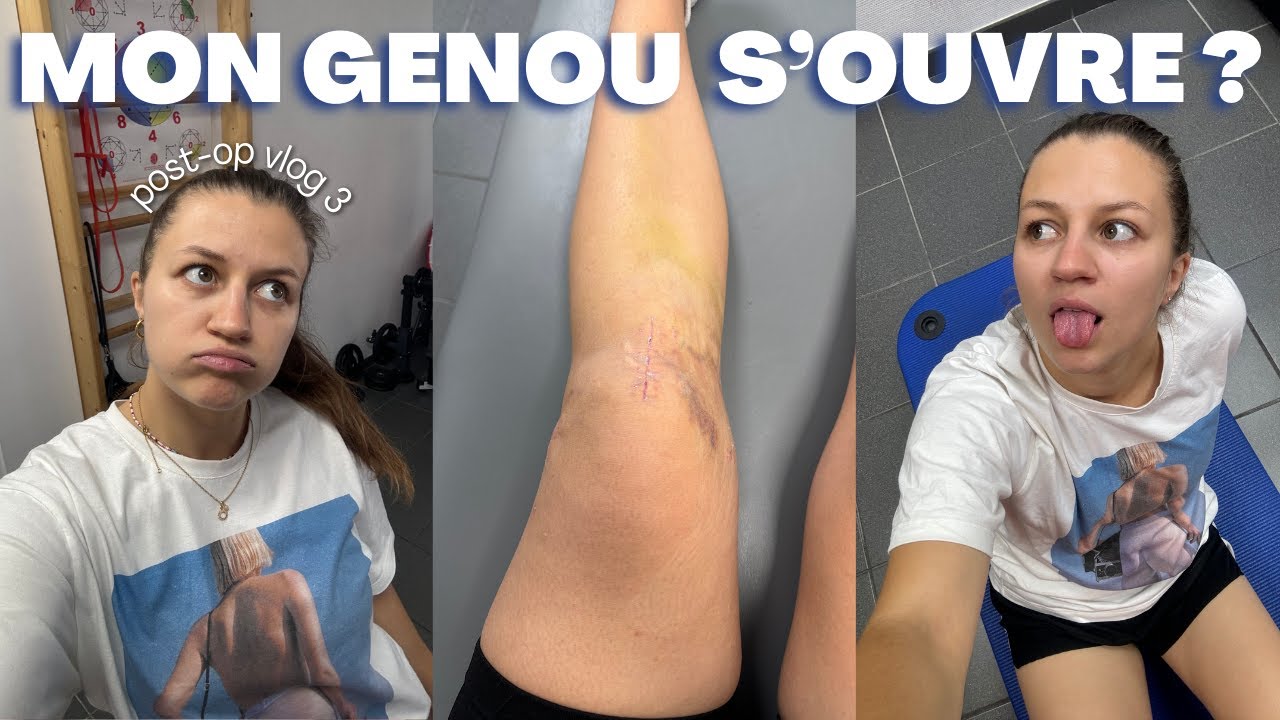 MON GENOU SE RÉOUVRE APRÈS L'OPÉRATION ?! | Post op vlog n°3 : agrafes, massage et grosse panique