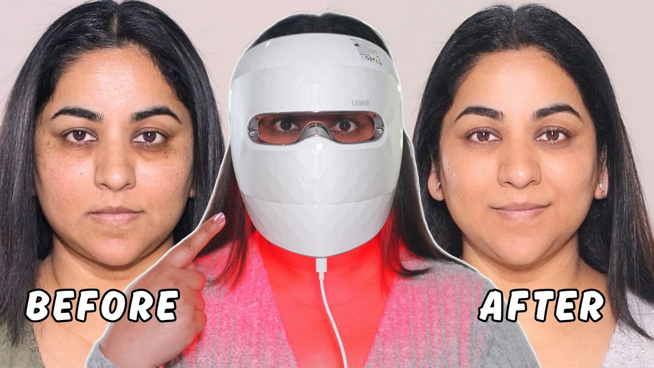 Do LED Masks Really Work? Red Light Therapy at Home (Transformation video)