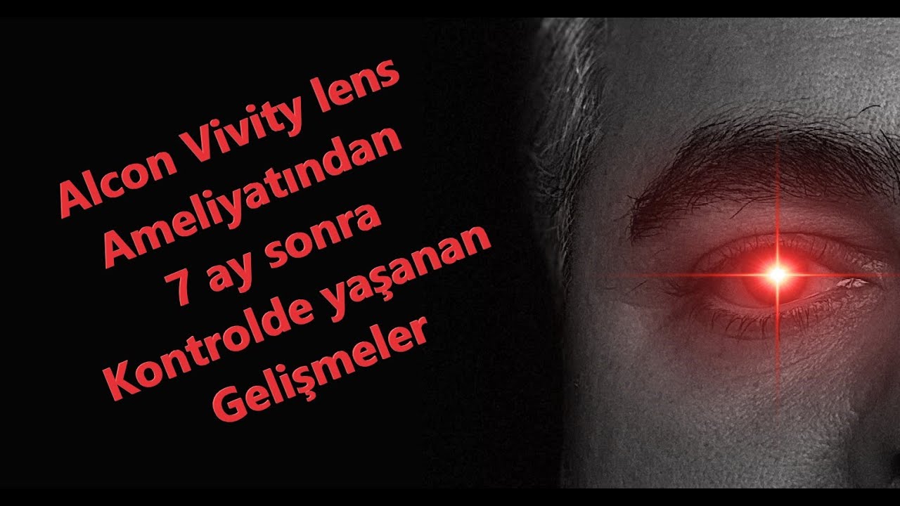 Alcon Akıllı Lens Deneyimi: 7. Ayda G&ouml;rd&uuml;ğ&uuml;m İnanılmaz Farklar! 👀