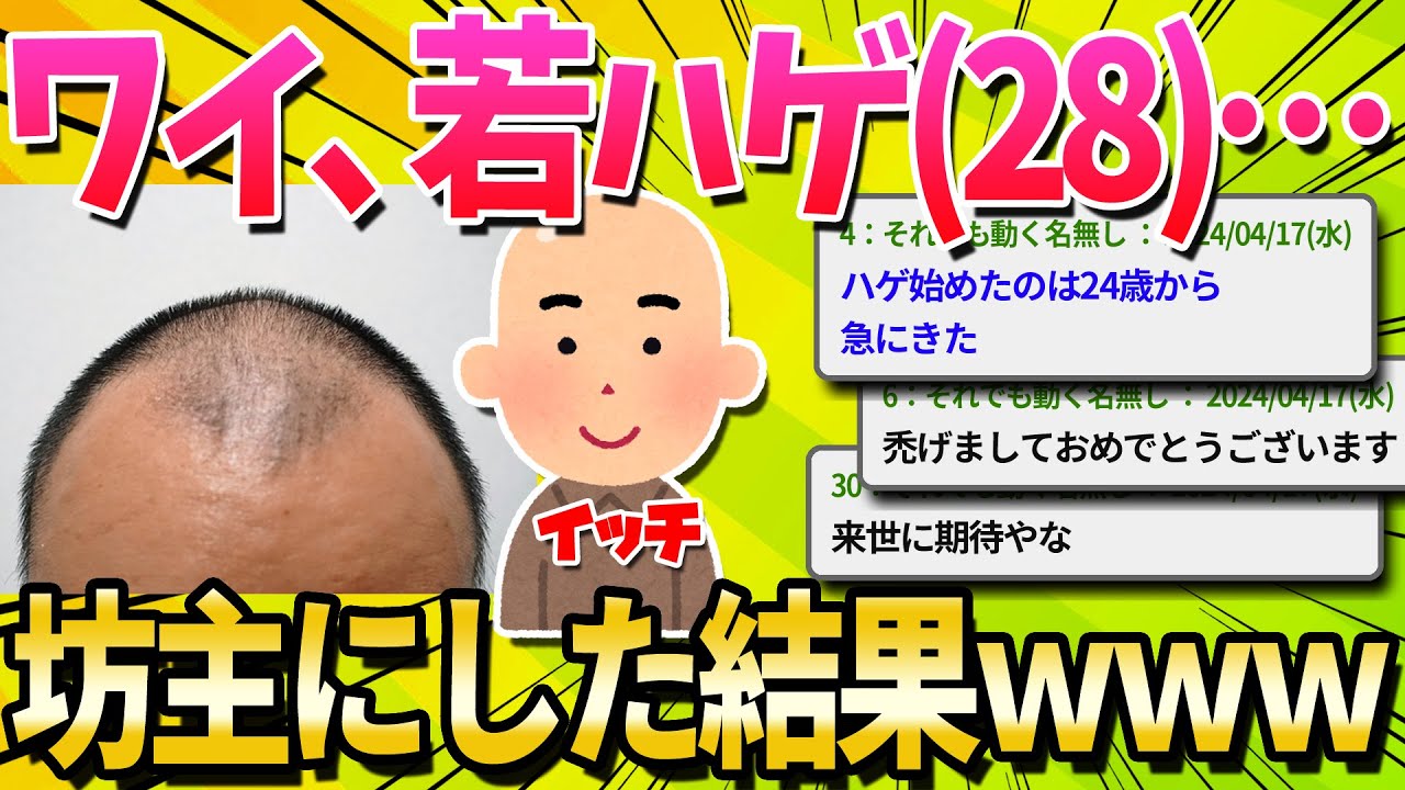 【悲報】若ハゲ(28歳)ワイ、思い切って坊主頭にした結果ｗｗｗｗｗ【ゆっくり解説】