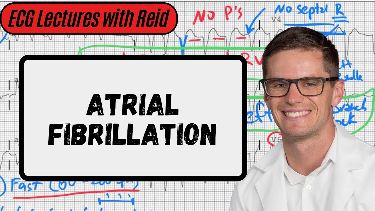Atrial Fibrillation | Day 13 ECG Challenge