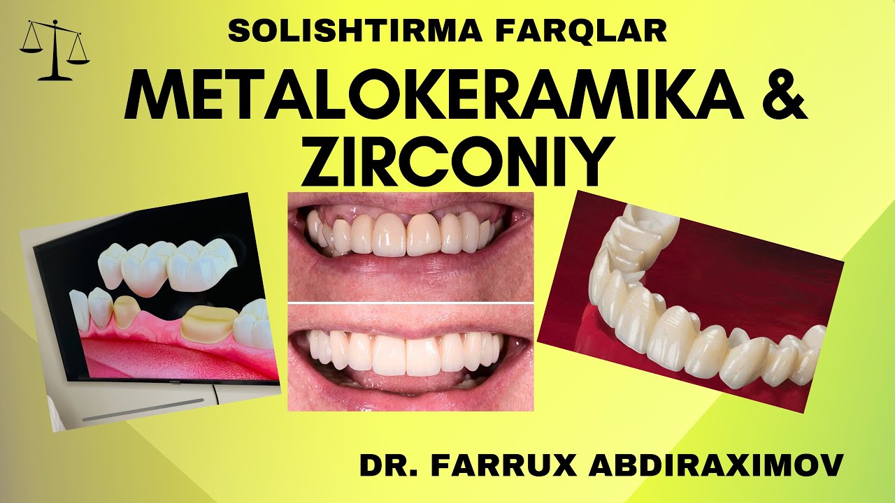 Metalokeramika & zirconia (serkoniy) tish farqlar va afzalliklari Uzbek tili Farrukh Dental clinic