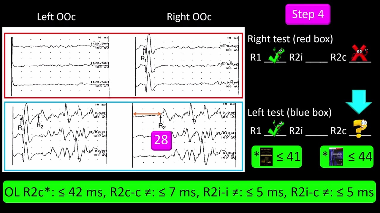 Blink Reflex Test. Practice 2