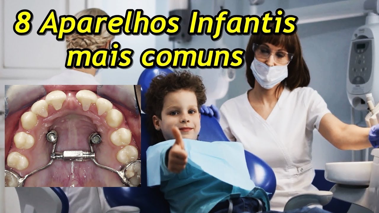 8 Principais Tipos de aparelho ortodôntico infantil