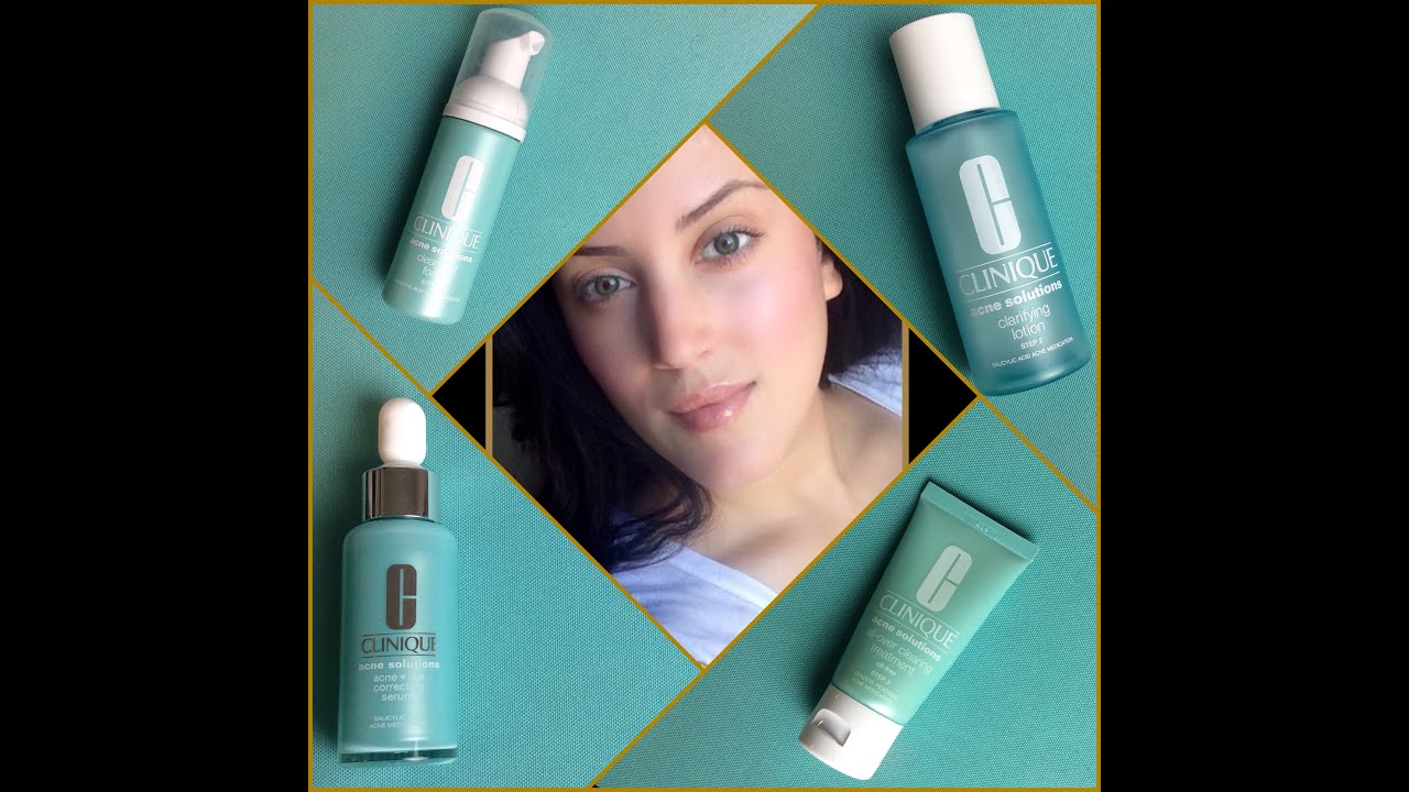 My acne is GONE!!! Clinique Acne Steps Saves  My Life