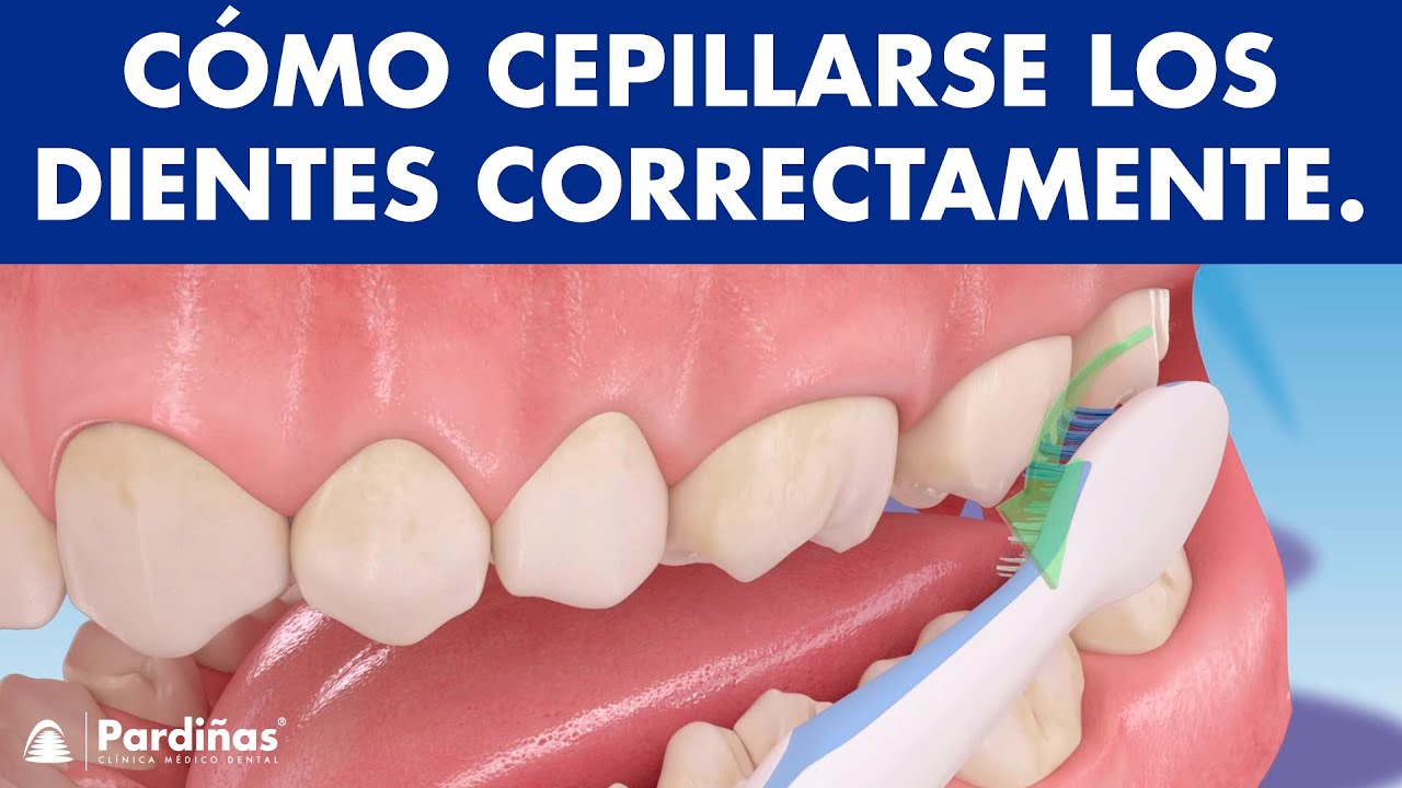 Cómo lavarse los dientes correctamente - El cepillado dental ©