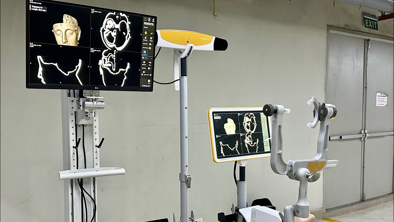 Định vị phẫu thuật thần kinh - Navigation - Brainlab