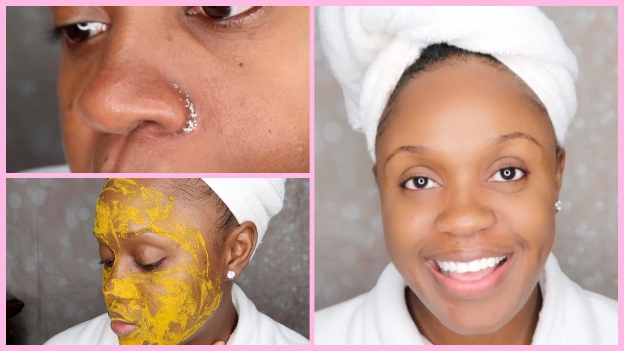 DIY FACIAL AT HOME WITH EXTRACTIONS | AFFORDABLE SKIN CARE ROUTINE