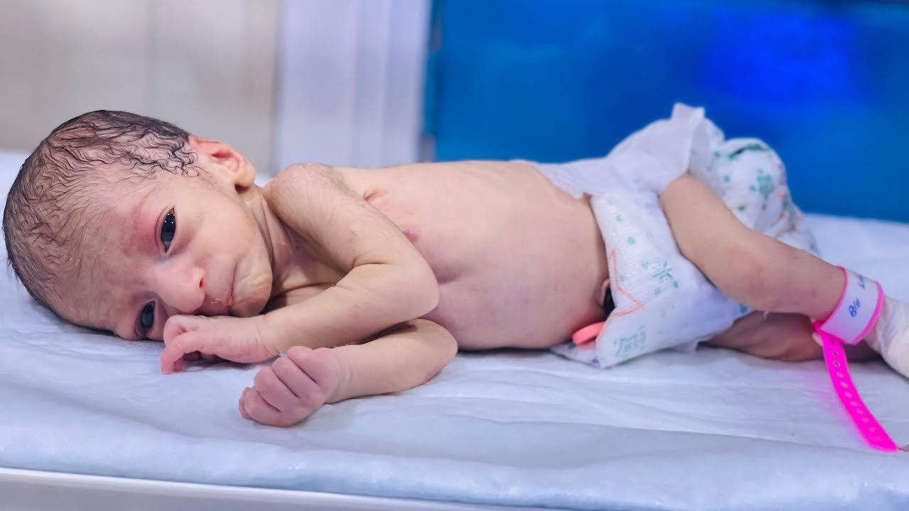 1.3kg Preemie Baby Care: Feeding, Massage & Incubator Support #nicu #baby