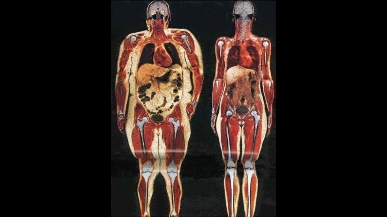 Lingh Zhi/ Reishi in der Therapie und gegen Zivilisationskrankheiten