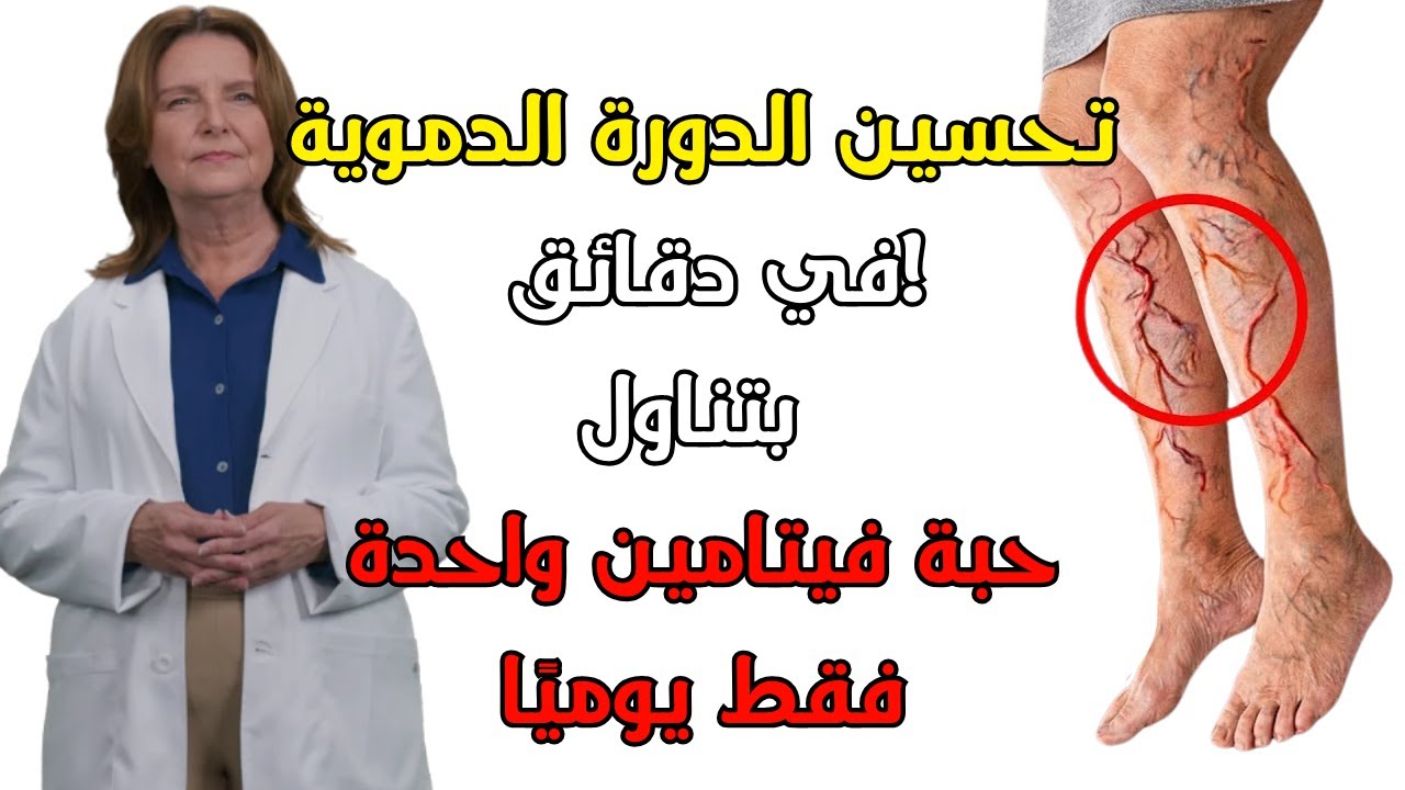 يذيب الجلطات: الفيتامين رقم 1 الذي ينظف أوردة الساق