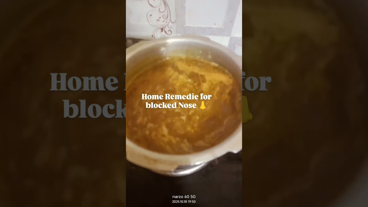 #youtubeshorts #shorts #home remidie for nose blocked #lifeisbutadream #try this tip