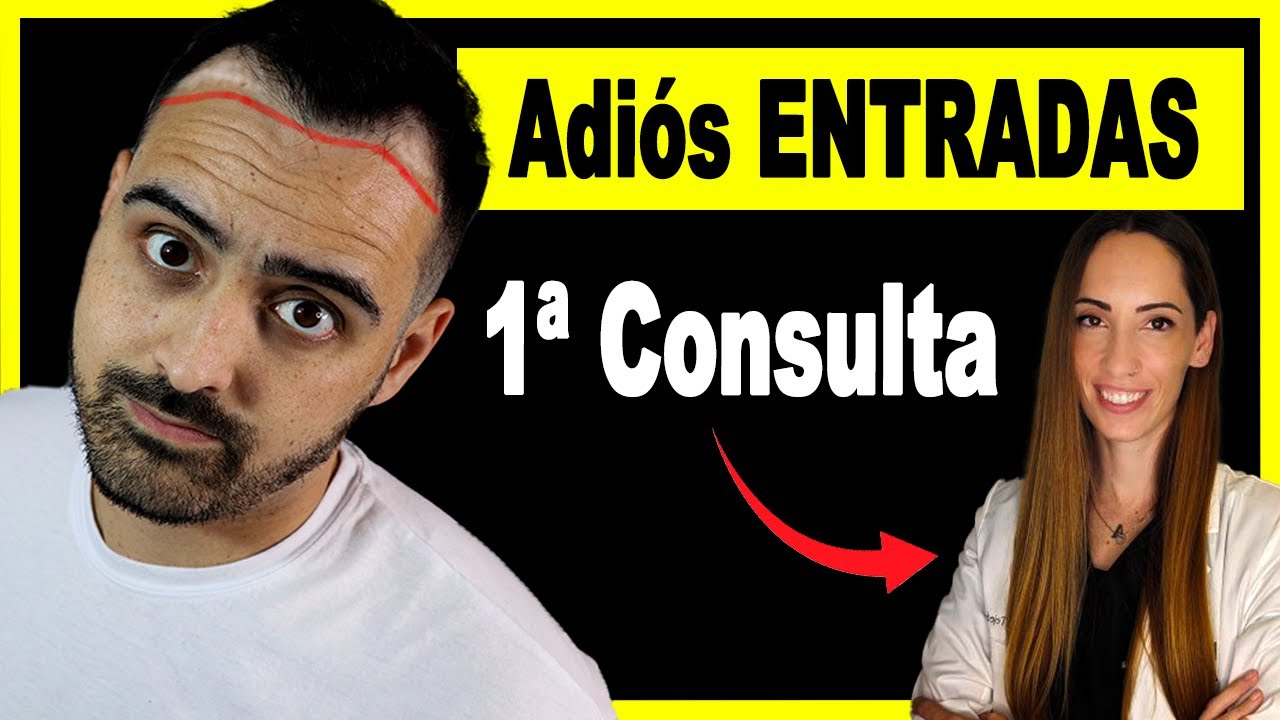 🔥MIRA este Video si Quieres un INJERTO CAPILAR en España🔥