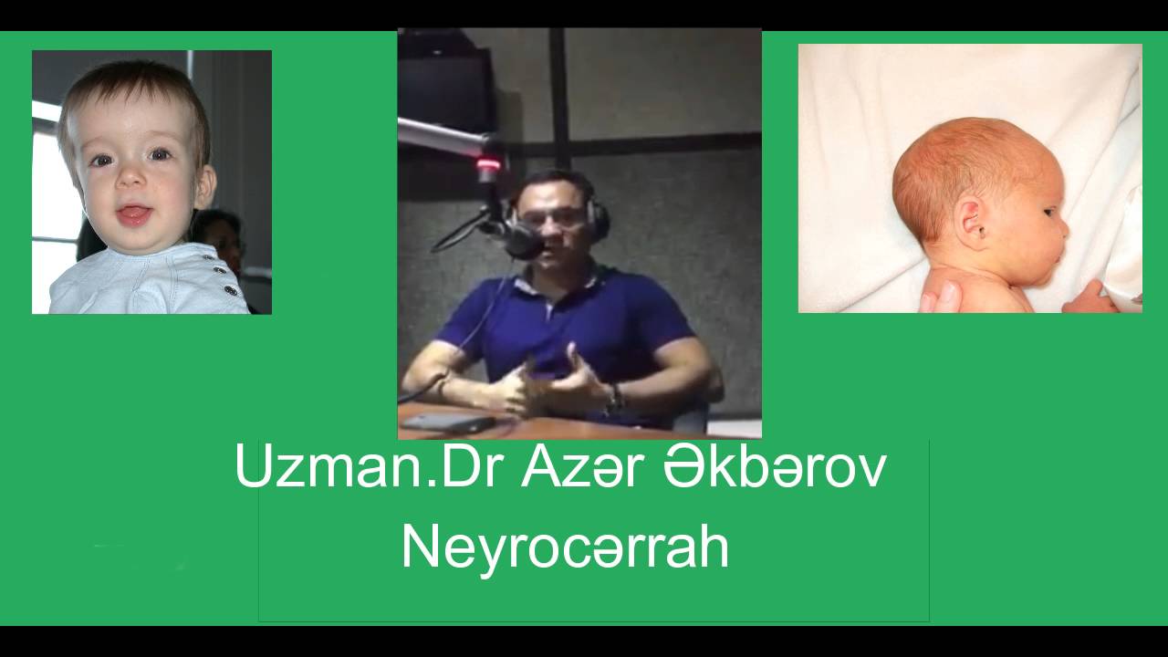 Uşaqlarda baş deformasiyası  (Hidrosefaliya və Sinastoz) haqqında Uzman Neyrocərrah Dr. Azər Əkbərov