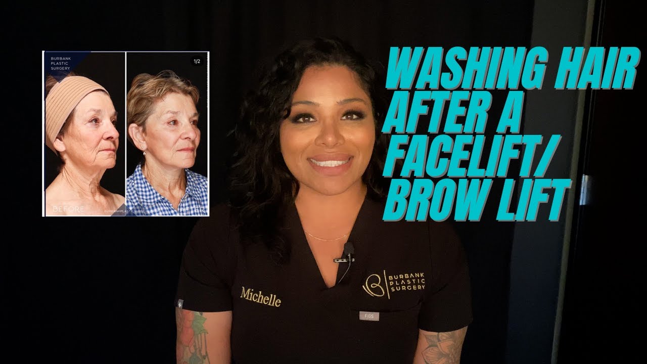 How to wash your hair after a facelift / brow lift?