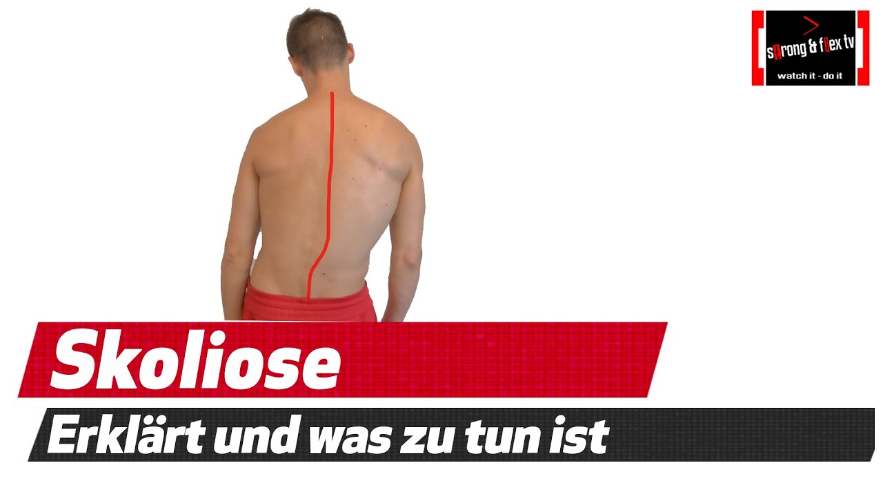 Skoliose - Ursachen - Lösungen
