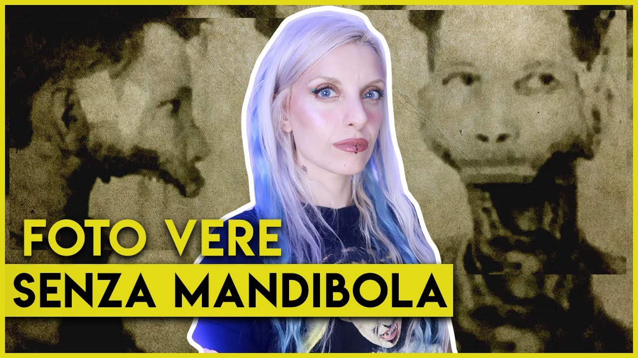 L'uomo a cui cadde la mandibola | BixCoven True Crime