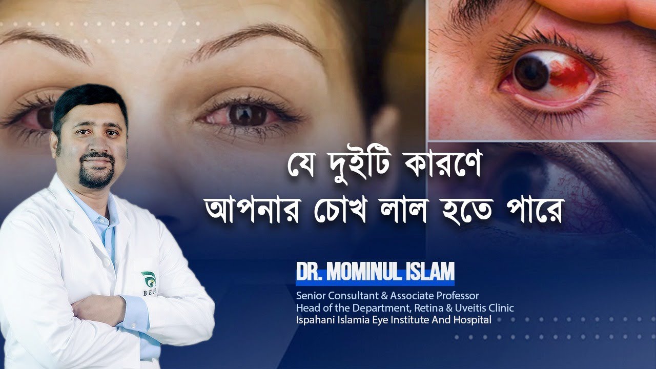 যে দুটি কারণে আপনার চোখ লাল হতে পারে
