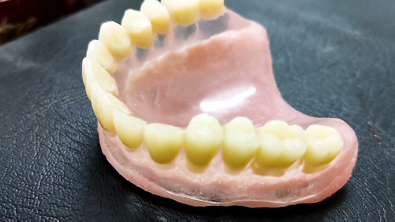 Complete Denture New Design