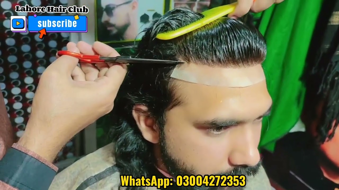 Front Line Patch  Non-Surgical Hair Replacement & Patch Raghib Qureshi +923004272353, 03184120846