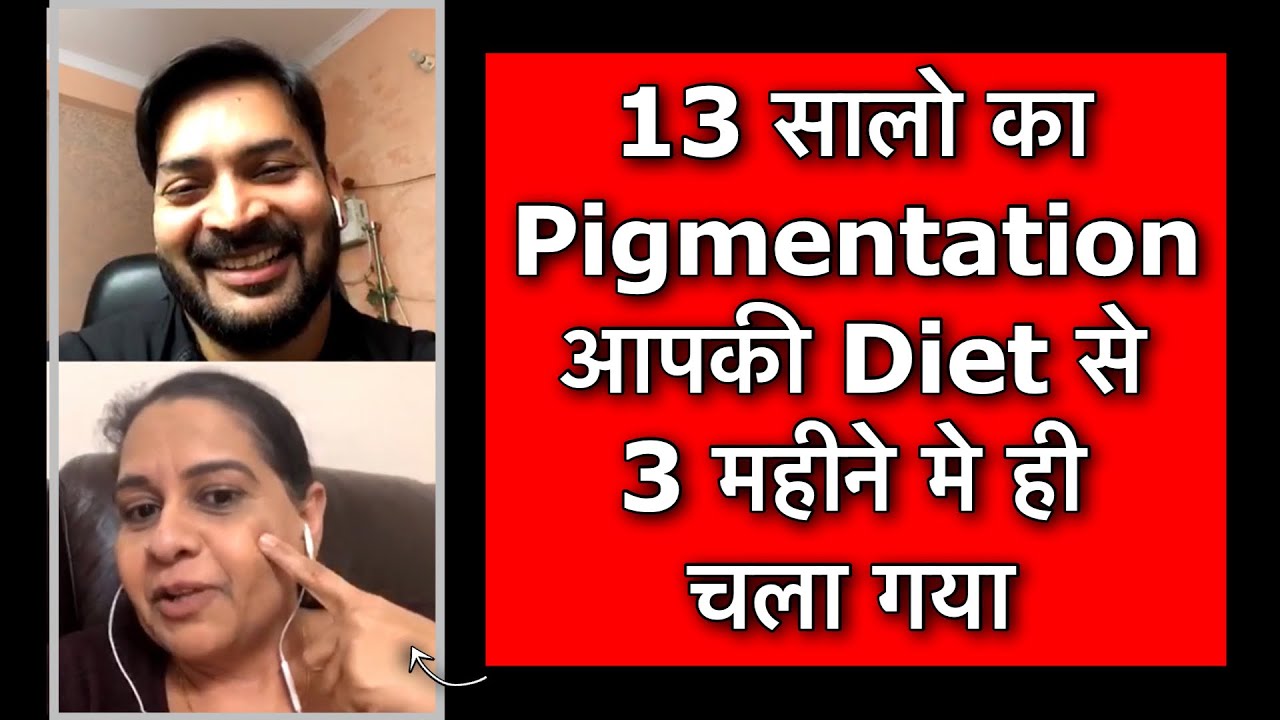 13 years of Pigmentation/Melasma gone in 3 months. Diet से 13 सालो की झाइयाँ 3 महीनों में चली गयी