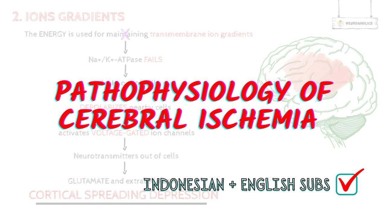 Pathophysiology of cerebral ischemia in detail | Neuroaholic