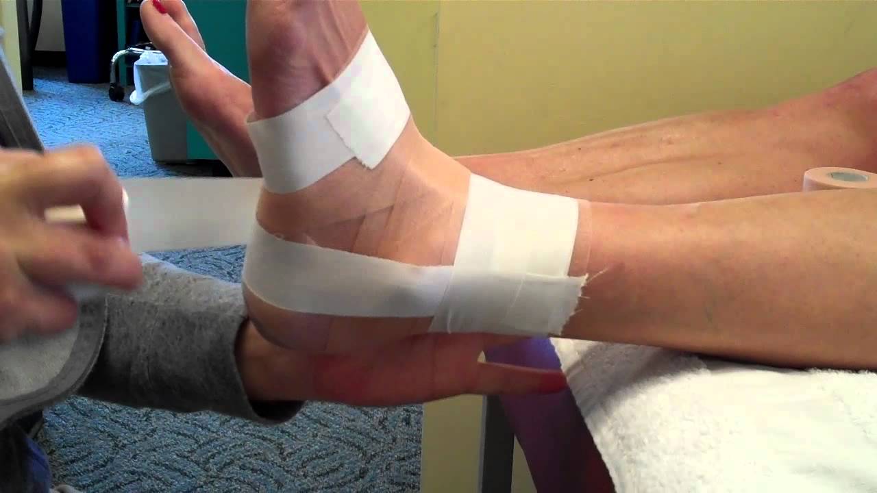 Ankle Taping Following Sprains or With Pain and Instablity