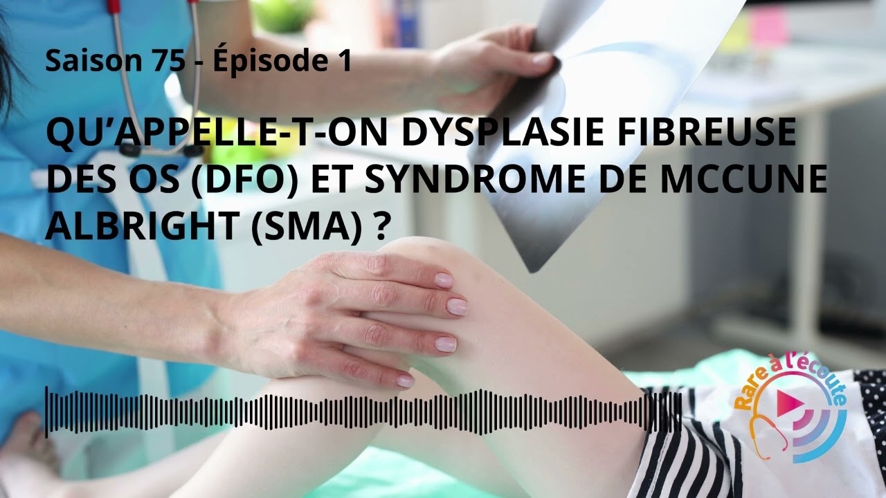 Maladie rare - Qu’appelle-t-on Dysplasie Fibreuse des Os (DFO) et Syndrome de McCune Albright (SMA)?