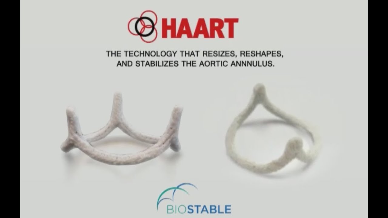 Aortic Valve Repair Innovation:  HAART 300 Ring Annuloplasty Device